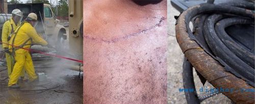 高壓清洗機(jī)工作中應(yīng)注意的安全問題